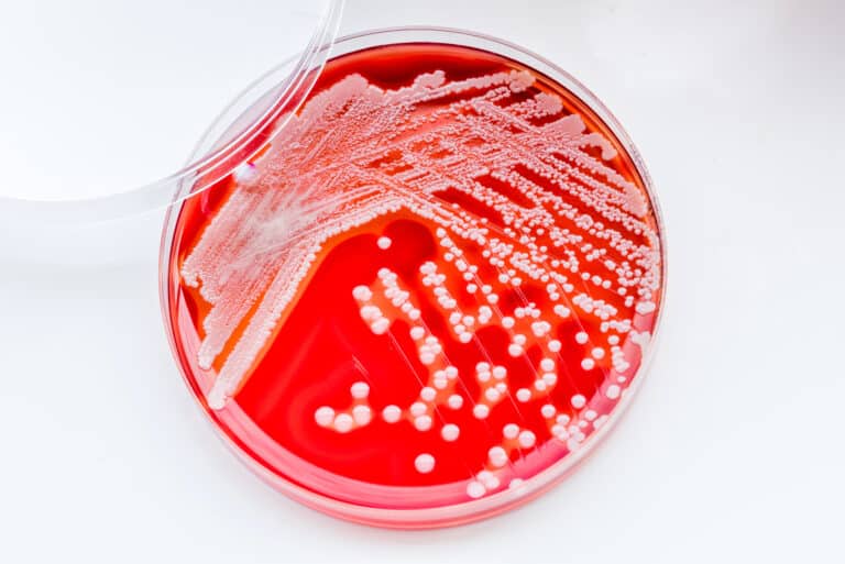 Staphylococcus aureus