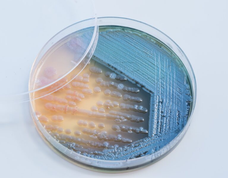Bacterial colonies culture on  selective agar media XLT Agar (Xy